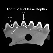 Tooth Visual Case Depths